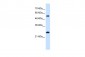 SMAD1 antibody - N-terminal region