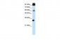 CTCF antibody - N-terminal region