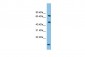 ECD antibody - middle region