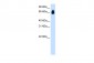 TRIM32 antibody - C-terminal region