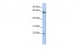 SUFU antibody - middle region