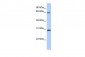 HOXA5 antibody - C-terminal region