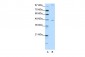 NR2F2 antibody - C-terminal region