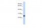 HOXB4 antibody - N-terminal region