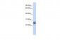 HOXB4 antibody - N-terminal region