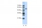 ZNF655 antibody - N-terminal region