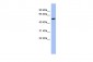 CBLL1 antibody - N-terminal region