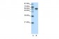 CBLL1 antibody - C-terminal region