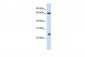 TRIM8 antibody - N-terminal region