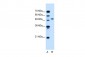 NR1I2 antibody - N-terminal region