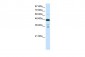 PRMT2 antibody - N-terminal region