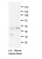 PRMT2 antibody - N-terminal region