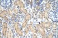 PRMT1 antibody - middle region