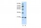 RPL9 antibody - C-terminal region
