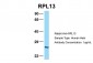 RPL13 antibody - C-terminal region