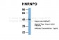 HNRPD antibody - N-terminal region