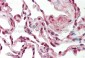 SFRS9 antibody - middle region