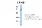 CPNE1 antibody - middle region