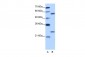 CPNE1 antibody - N-terminal region