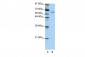 STAU1 antibody - N-terminal region