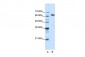 NXF1 antibody - N-terminal region