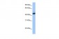 KHDRBS1 antibody - N-terminal region