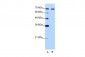 CARF antibody - C-terminal region