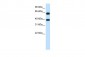 NXF3 antibody - C-terminal region