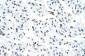 MATR3 antibody - N-terminal region