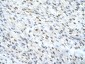 MATR3 antibody - N-terminal region