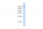 MATR3 antibody - N-terminal region