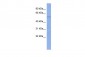 PTBP2 antibody - N-terminal region