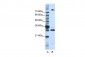 FUSIP1 antibody - C-terminal region