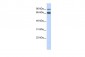 FZD10 antibody - N-terminal region