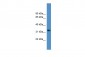 WDR5 antibody - C-terminal region