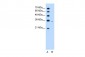 PRPS2 antibody - middle region