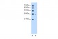 PRPS2 antibody - middle region