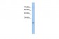 GSTM1 antibody - N-terminal region