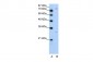 PTGS1 antibody - N-terminal region