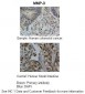 MMP3 antibody - middle region