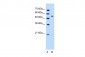 PLIN antibody - N-terminal region