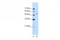 PBEF1 antibody - C-terminal region