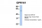 GPR161 antibody - middle region