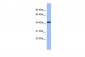 SERPINB13 antibody - N-terminal region