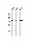 ERCC1 Antibody (C-term)
