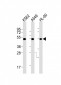 AVPR1A Antibody (C-term)