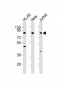 IKK beta Antibody