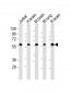 PPP2R1B Antibody