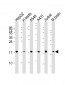 EEF1E1 Antibody