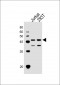 ETS1 Antibody (N-term)